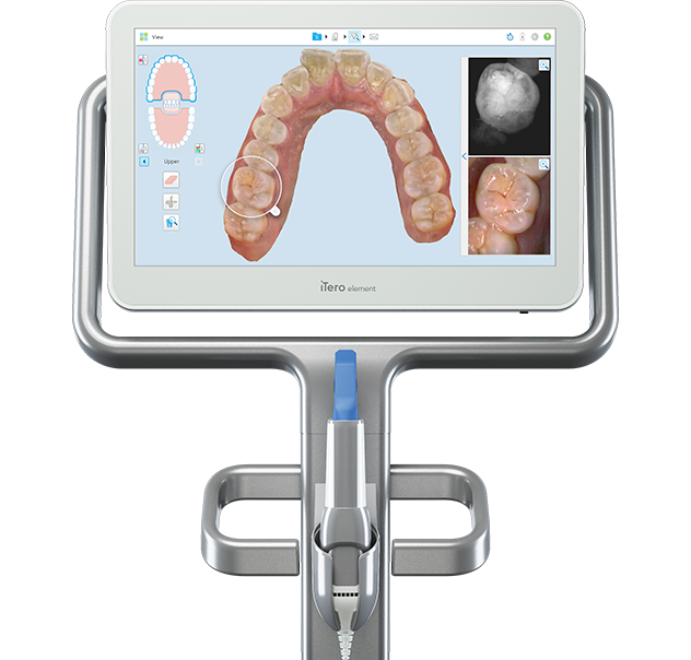 Concord CA iTero Scanner: Digital Dentistry