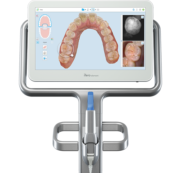 ITero Digital Dentistry X Ray Technology