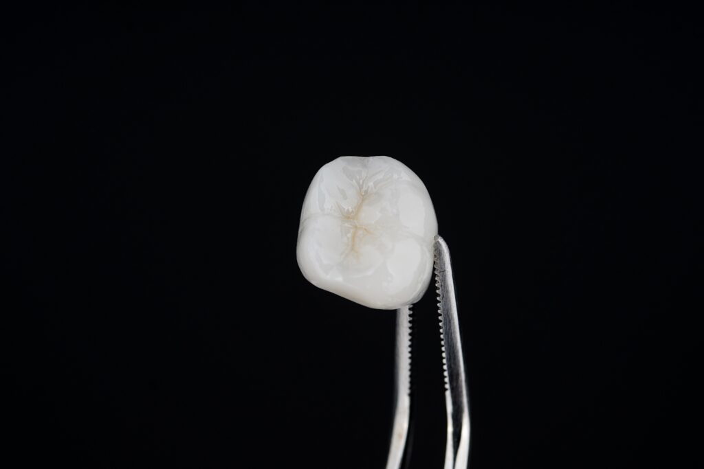 Dental Crowns Concord