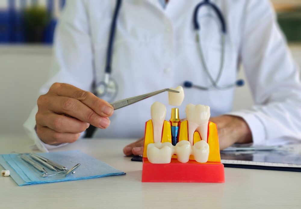 Dental Implants Concord