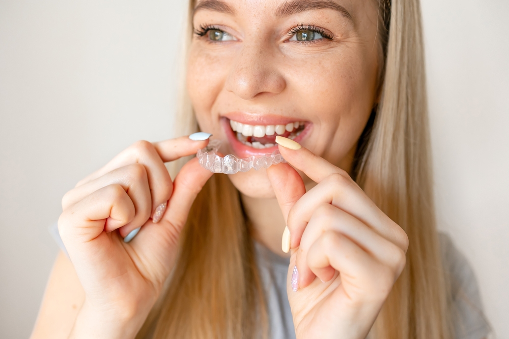 invisalign in concord